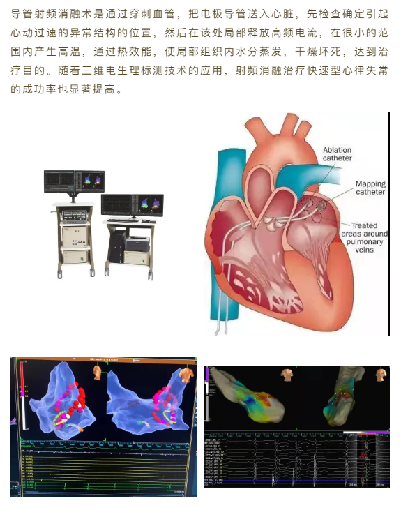 虎扑旧城大神发过的图_尸毒过木阵_阵发性室上性心动过扑
