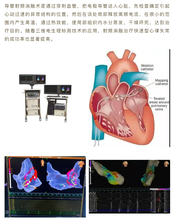 bnnnu.com报码室过_阵发性室上性心动过扑_2016上砂新闻上砂过老