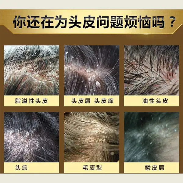 拼多多删除的订单怎么找回_怎么恢复拼多多删除订单_怎么恢复拼多多订单删除记录